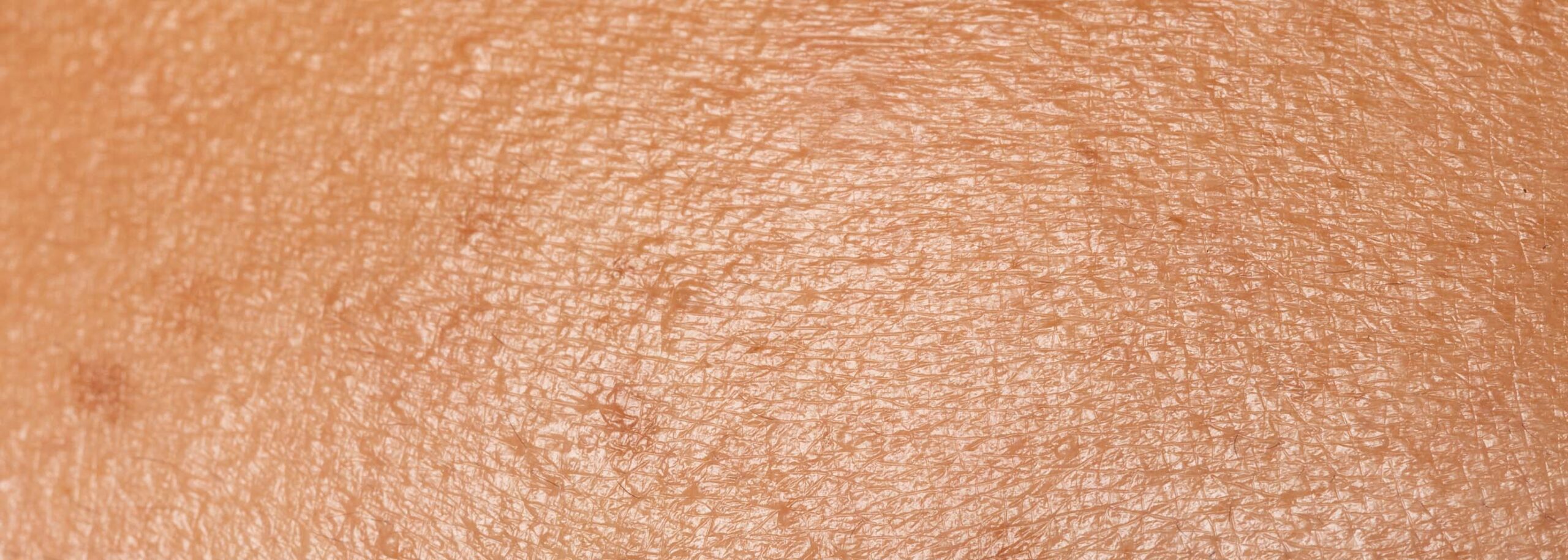 Macro shot of oily skin