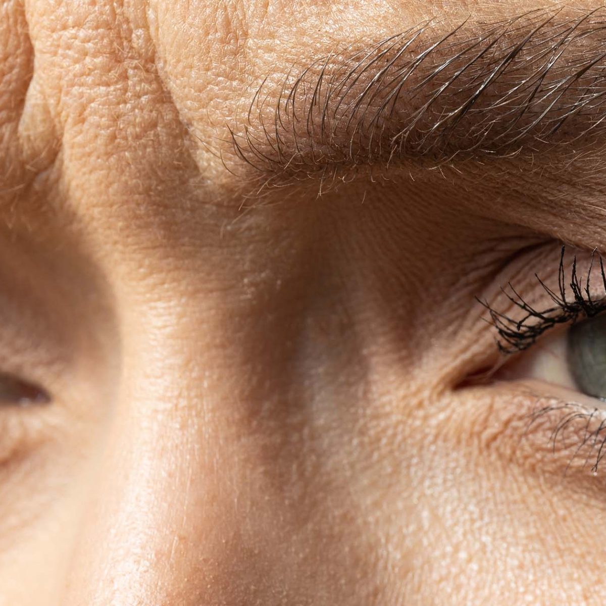 nexuspharma-nextoxin-for-glabellar-lines-featured